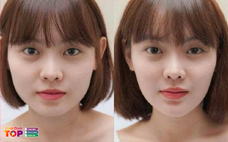 Vien-tham-my-mytrang-binhdinhtoplist