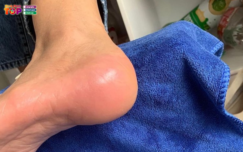 Ningnails-binhdinhtoplist