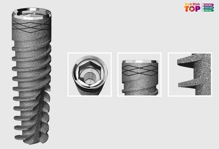 Chon-dung-tru-implant-nen-tang-cho-ca-trong-rang-thanh-cong-va-lau-dai-1